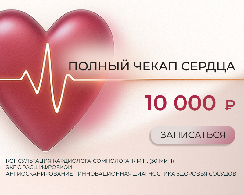 Чекап